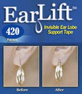 Earring Support Patches 7 Pack T8602