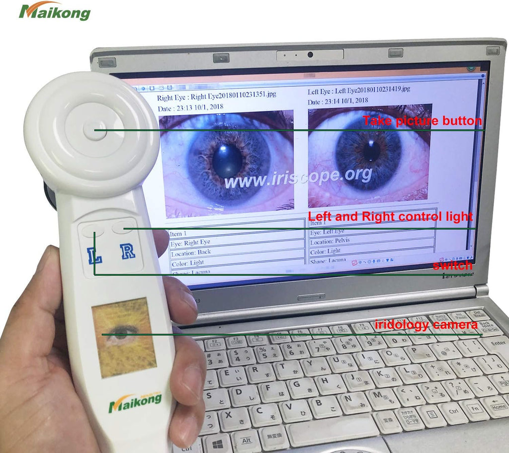 USB Iridology Camera with Software G3102