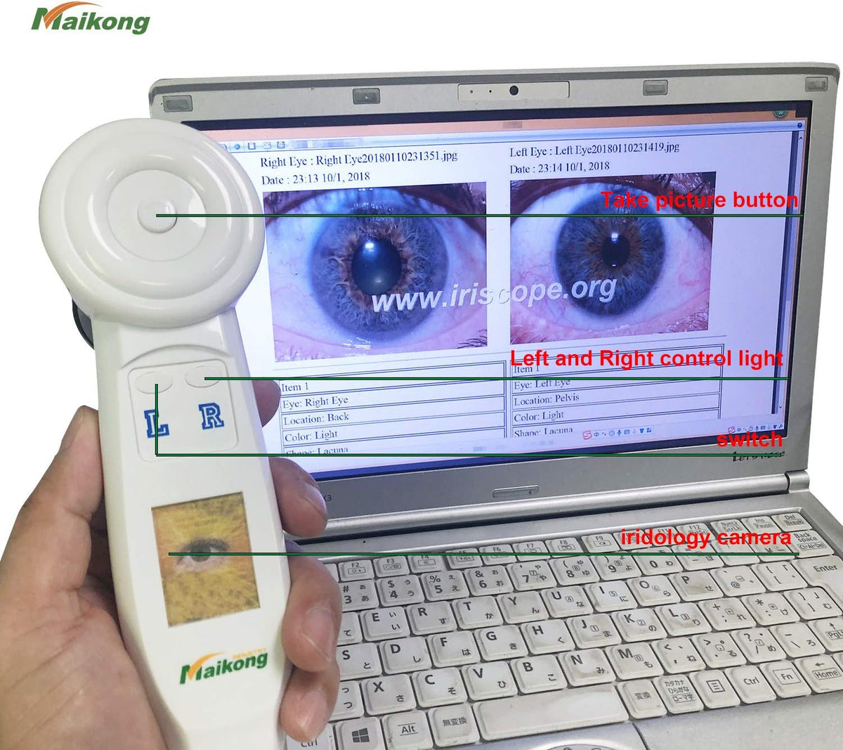 USB Iridology Camera with Software G3102