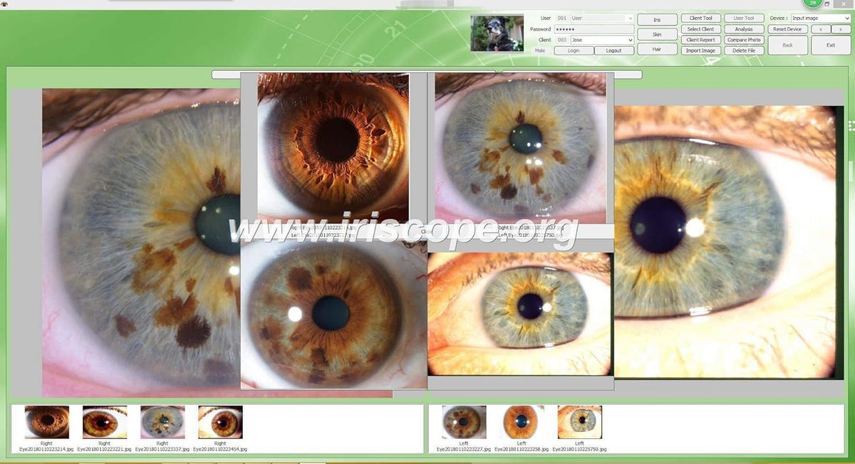 USB Iridology Camera with Software G3102